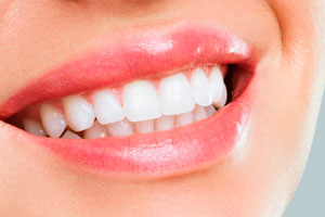 Эстетическая рестоврация зуба после лечения кариеса