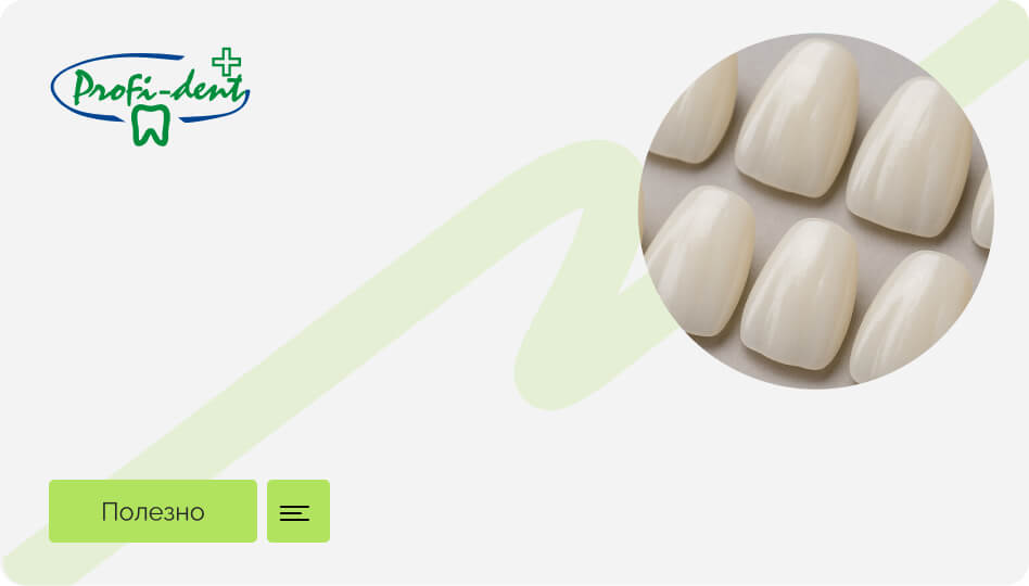 Когда стоит рассмотреть установку виниров на зубы?