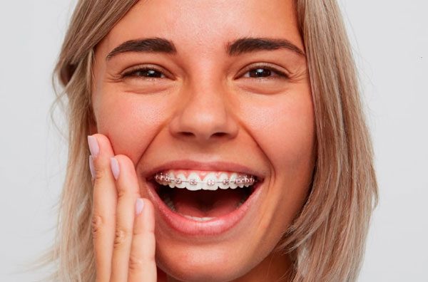 Как снимают брекеты